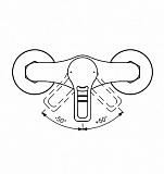 Смеситель для душа Vidima Hype BA398AA